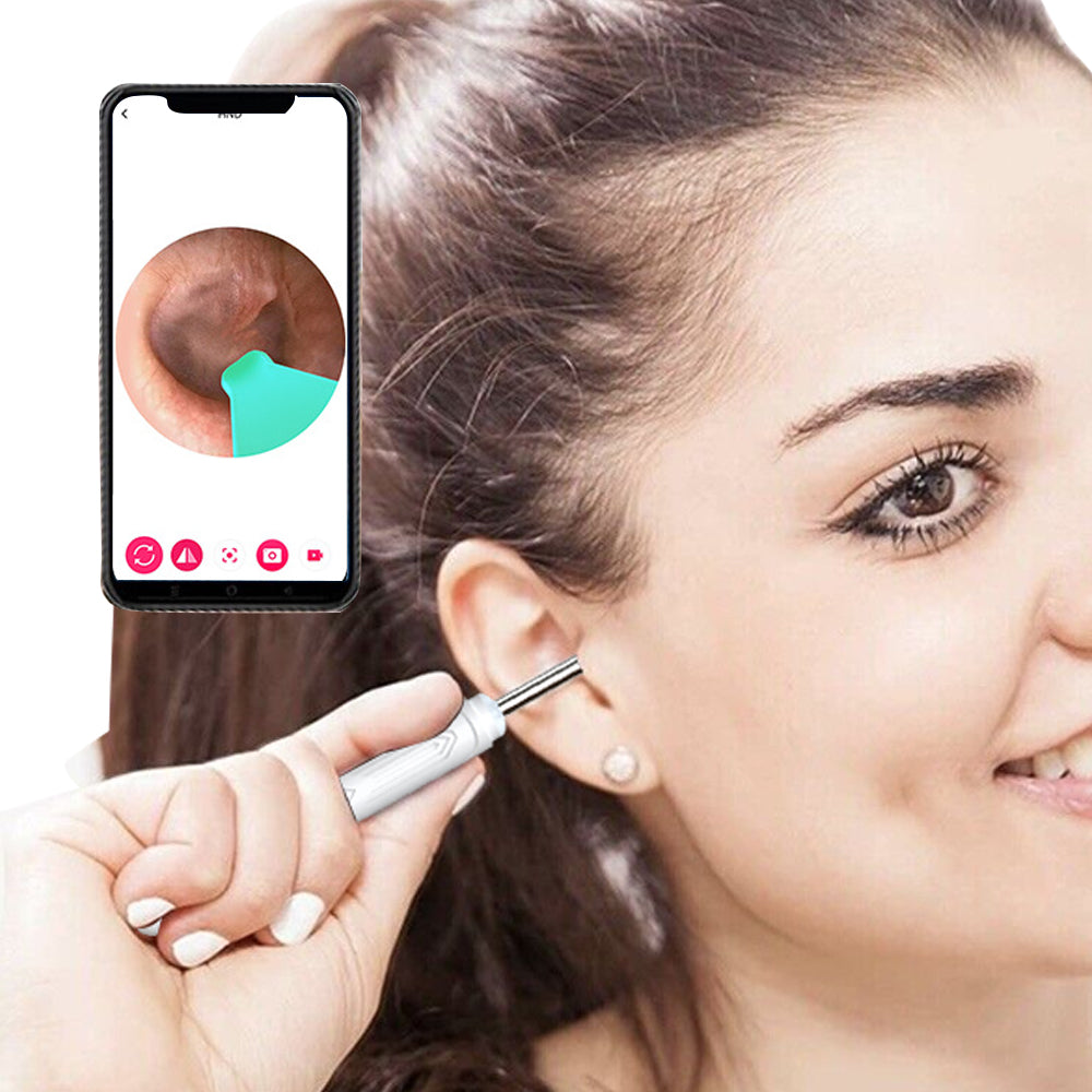 Wireless Otoscope Ear Wax Remover with Ear Camera