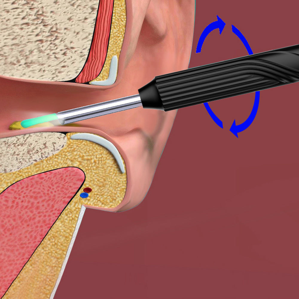 WIFI Connection Ear Wax Removal Tool Ear Set Camera Wireless Visual Ear Otoscope