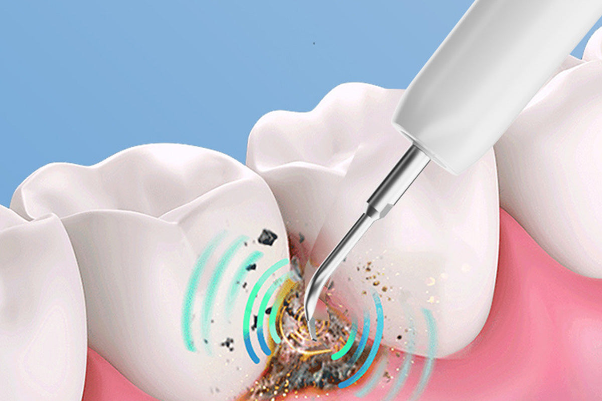 Ultrasonic Dental Cleaner Smart Tartar Remover with UV Care and 5 Cleaning Modes