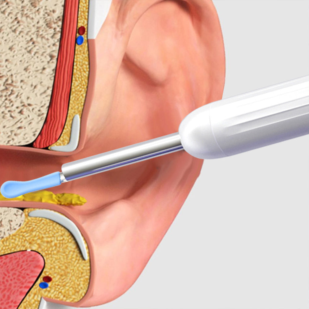 Wireless Ear Wax Removal Visual Ear Pick 6 LED Endoscope Otoscope with 8 Handheld Ear Sets