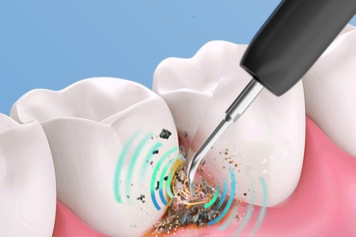 Ultrasonic Dental Cleaner Smart Tartar Remover with UV Care and 5 Cleaning Modes