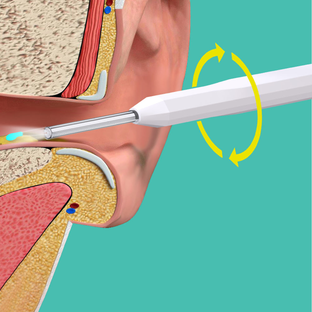WIFI Connection Ear Wax Removal Tool Ear Set Camera Wireless Ear Endoscope Spoon