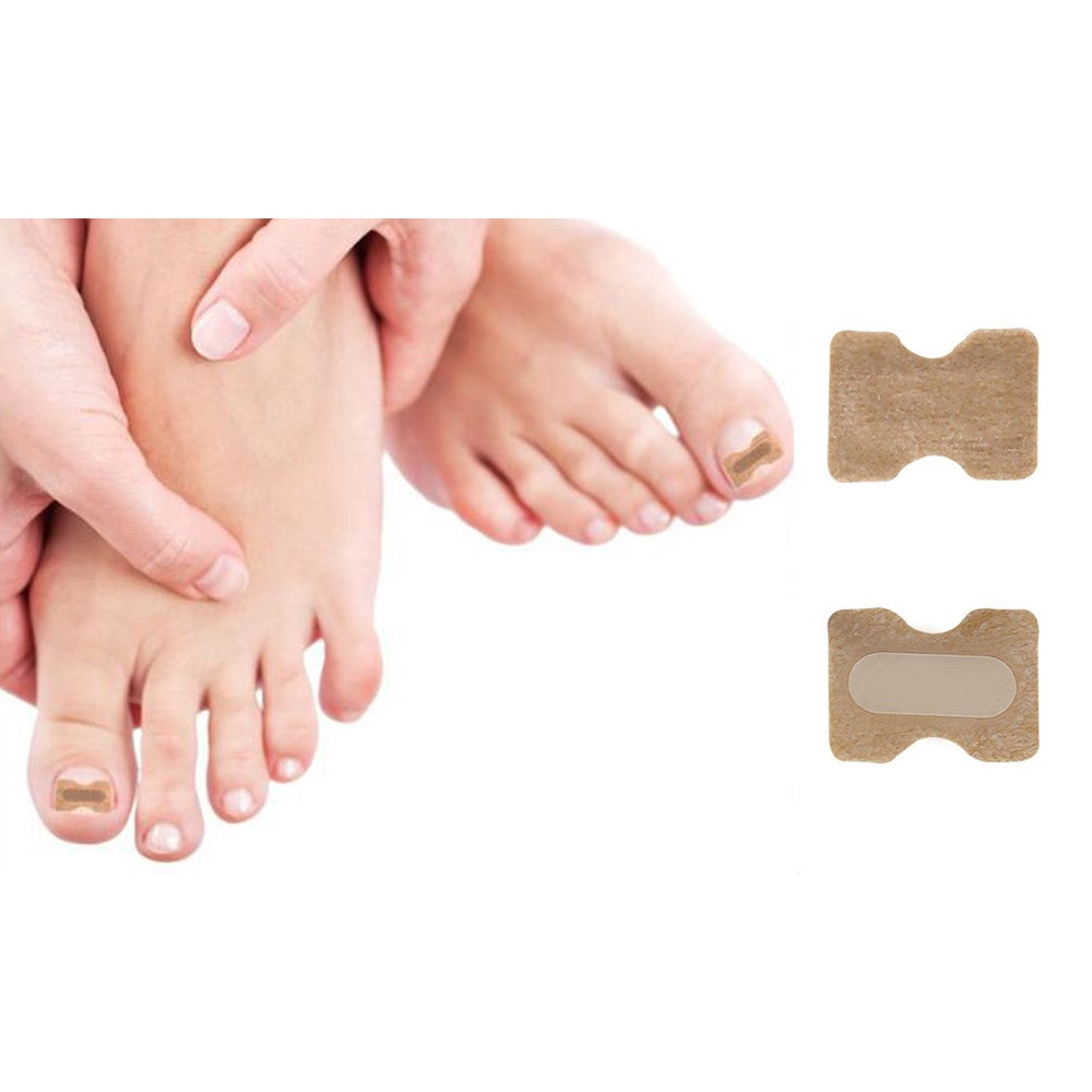 100Pcs Toenail Ingrown Correction Stickers