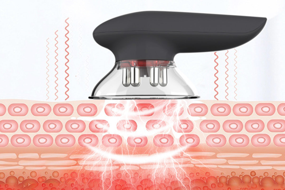 3-in-1 Electric Cupping Massager with EMS Red Light Vacuum Suction