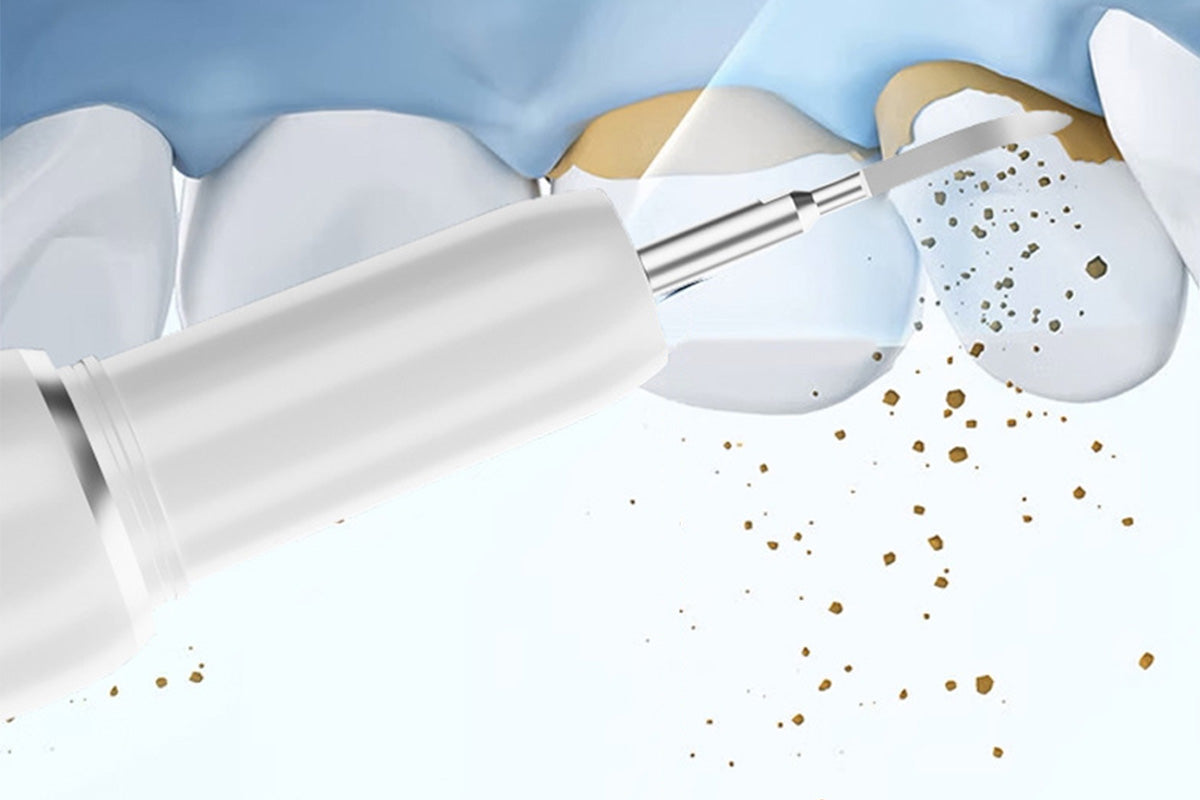 Ultrasonic Dental Cleaner Smart Tartar Remover with UV Care and 5 Cleaning Modes