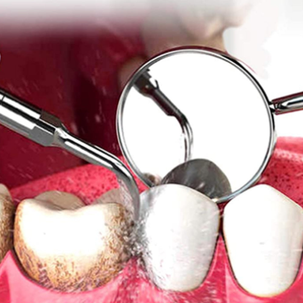Electric Teeth Cleaning Kit With LED Light