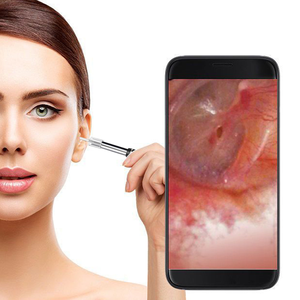 Ear Wax Removal Endoscope Earwax Remover Tool Ear Camera Ear Otoscope with 6 LED Lights