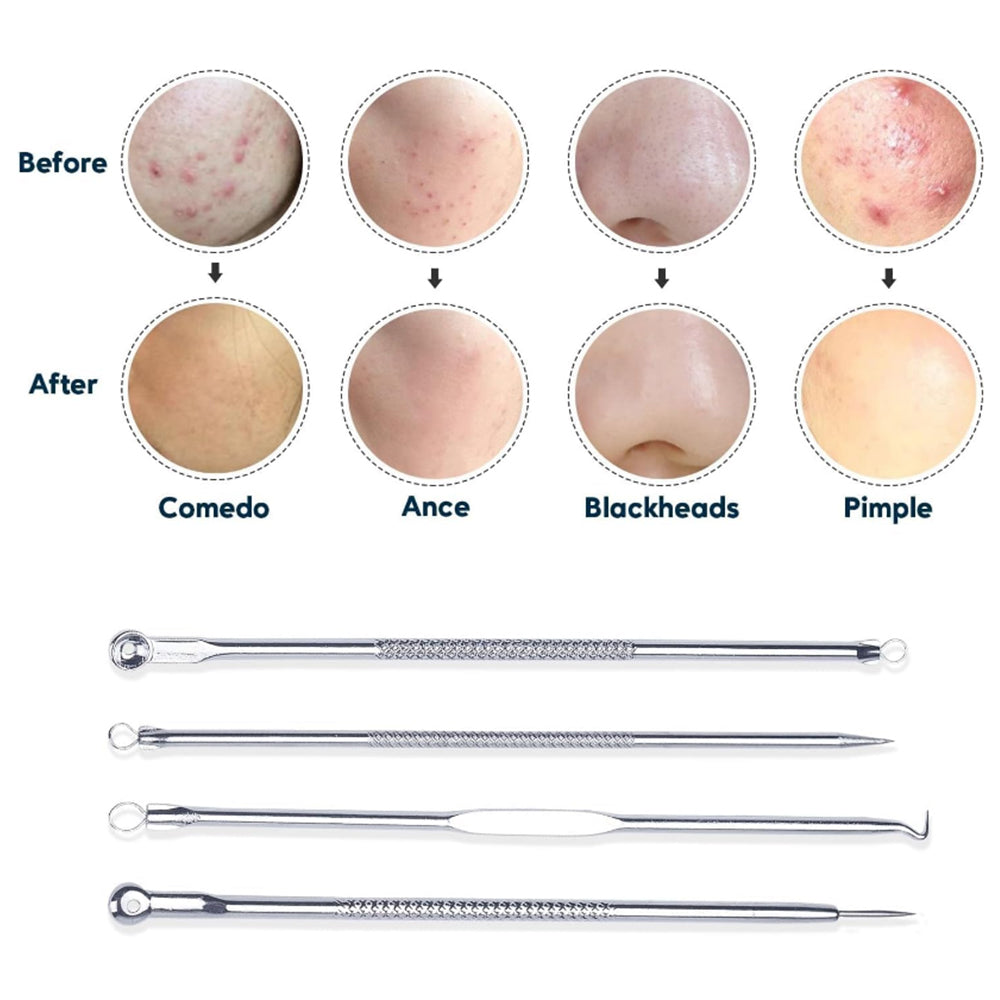 2Pcs Vacuum Blackhead Remover Facial Skin Pore Acne Pimple with 5 Suction Probes 4 Acne Needles