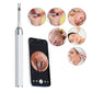 2-in-1 Visual Ear Wax Removal Tool with Ear Scoop and Tweezer