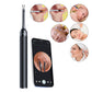 2-in-1 Visual Ear Wax Removal Tool with Ear Scoop and Tweezer