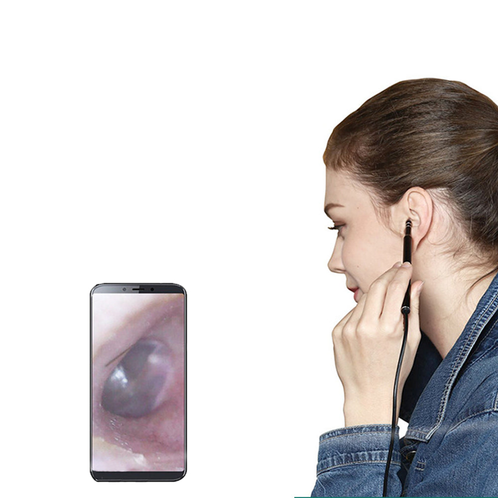 3-in-1 Smart HD Visual Ear Pick with Camera for Ear Wax Removal