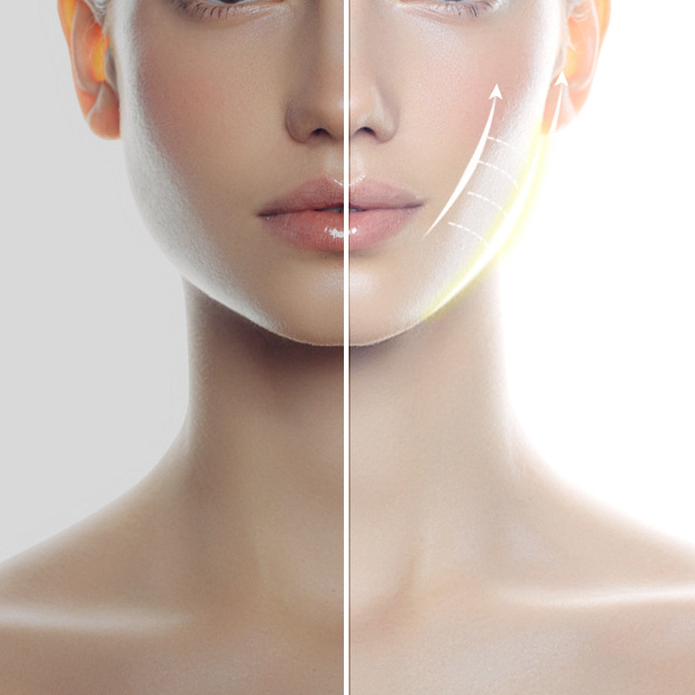 EMS Microcurrent V-Face Slimming Device with Red Blue Light and Adjustable Lift Band