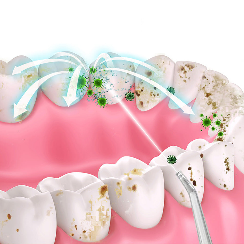 Cordless Electric Water Flosser Teeth Cleaner Portable Oral Irrigator with 4 Nozzles