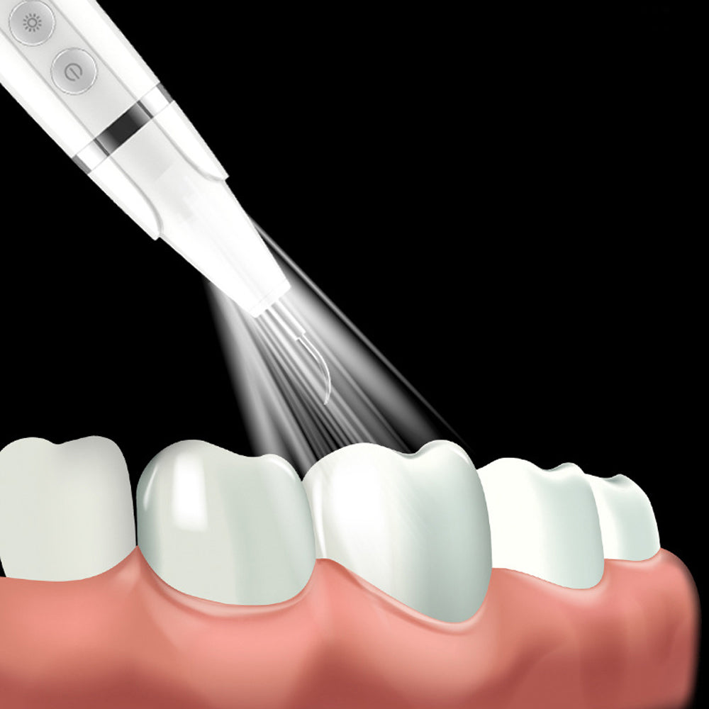 Electric Teeth Cleaning Kit With LED Light
