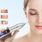Rechargeable Nine Level Adjustable Skin Spot Removal Pen LCD Plasma Pen