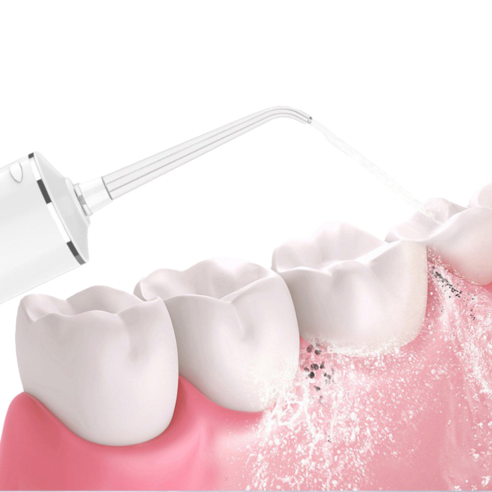 Cordless Water Flosser Teeth Cleaner 300ML Dental Flosser with 4 Jet Tips