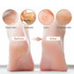 Rechargeable Electric Foot Callus Remover Kit