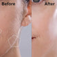4Pcs Replacement Heads for Facial Hair Remover 18K Gold Plated Blades