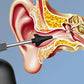 Automatic Electric Ear Cleaner Kits