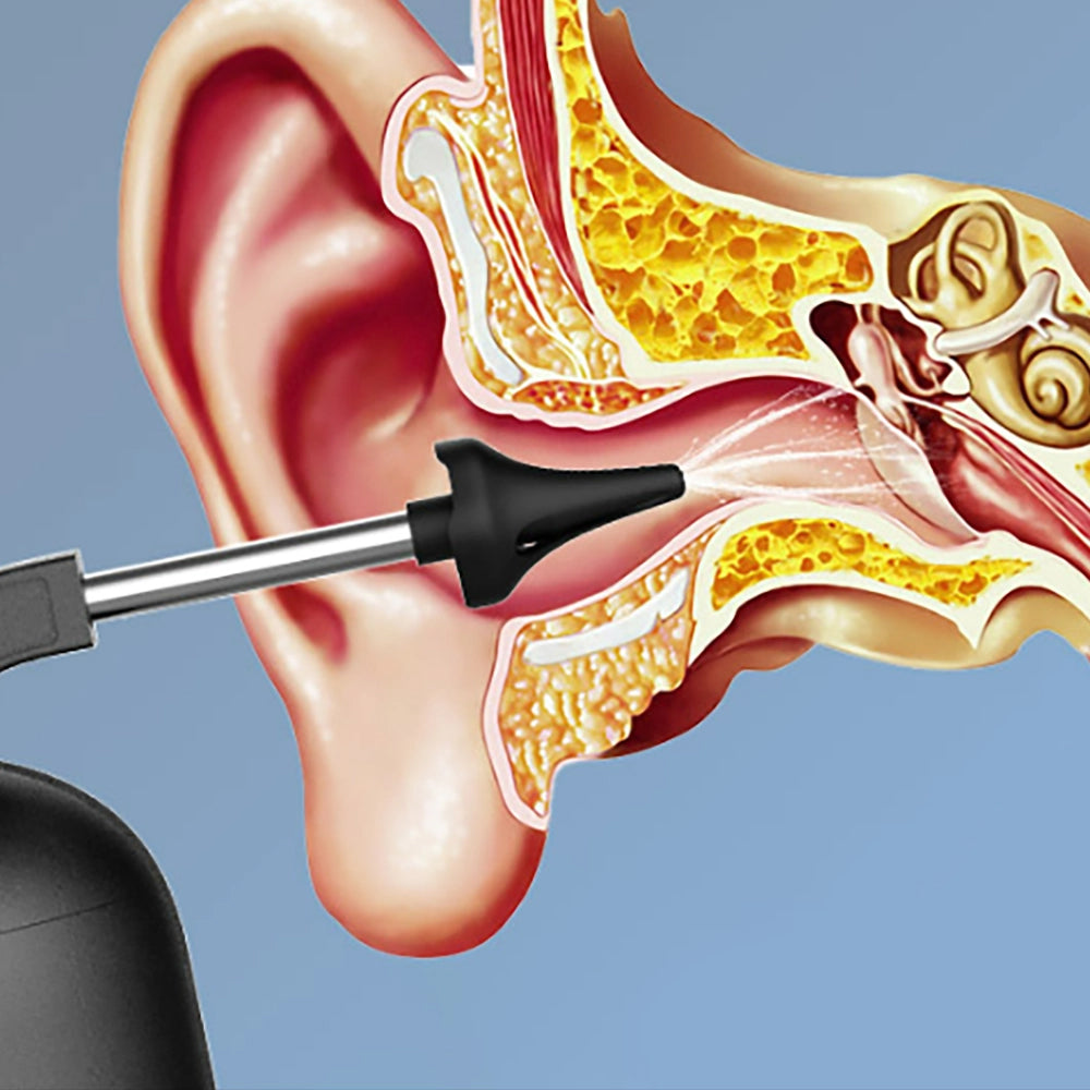 Automatic Electric Ear Cleaner Kits