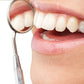 Electric Teeth Cleaning Kit