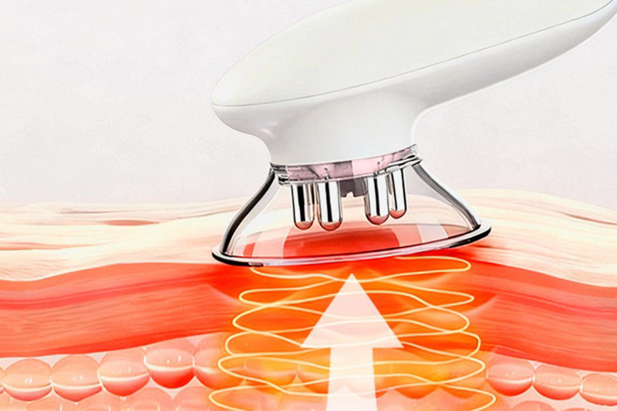 3-in-1 Electric Cupping Massager with EMS Red Light Vacuum Suction