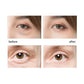 Warm Eye Massager for Dark Circle Relief & Fine Line Care