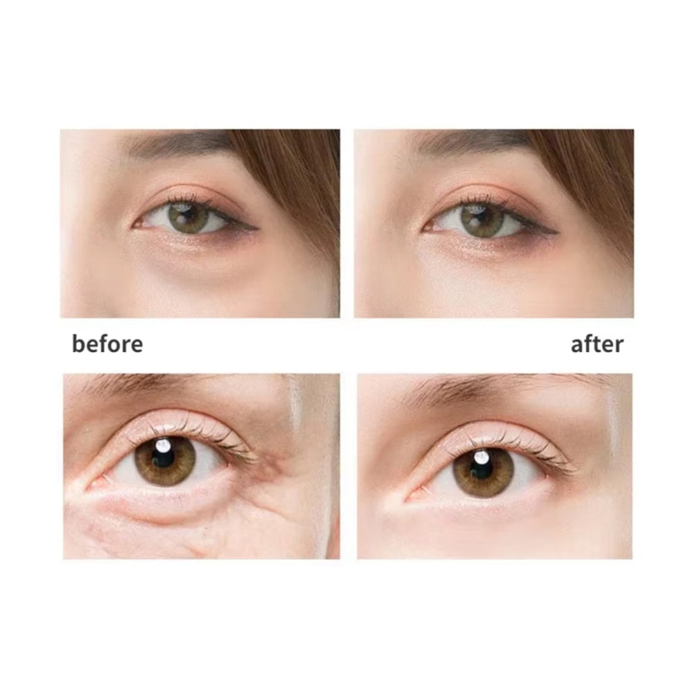 Warm Eye Massager for Dark Circle Relief & Fine Line Care