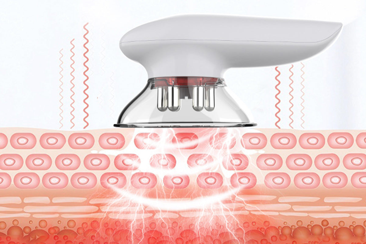 3-in-1 Electric Cupping Massager with EMS Red Light Vacuum Suction