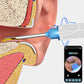 Ear Wax Removal Visual Ear Cleaner Ear Wax Removal Tool Kit