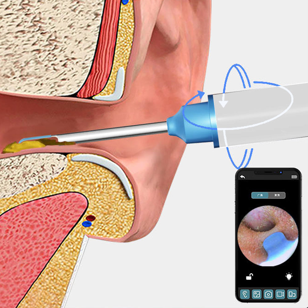 Ear Wax Removal Visual Ear Cleaner Ear Wax Removal Tool Kit
