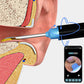 Ear Wax Removal Visual Ear Cleaner Ear Wax Removal Tool Kit