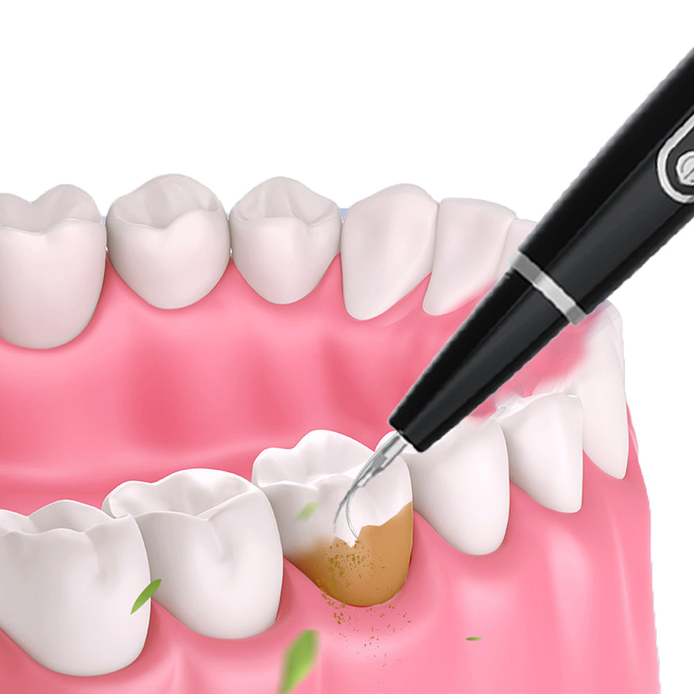 Electric Dental Calculus Removal Teeth Cleaning Kit With LED Light