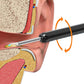 Wireless WiFi Ear Wax Removal Kit with HD Camera 360 Degree Visual Ear Cleaner