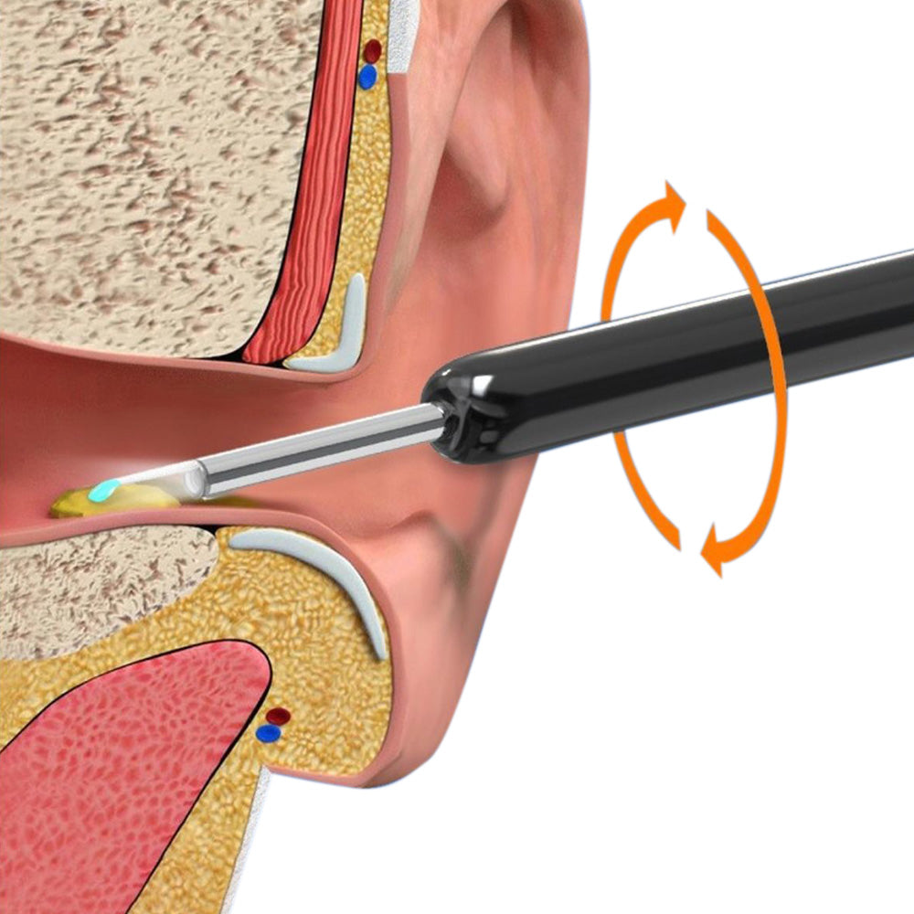 Wireless WiFi Ear Wax Removal Kit with HD Camera 360 Degree Visual Ear Cleaner