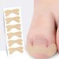 120Pcs Ingrown Toenail Correction Stickers