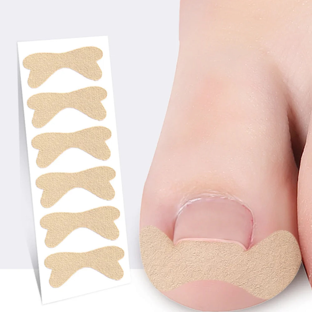 120Pcs Ingrown Toenail Correction Stickers