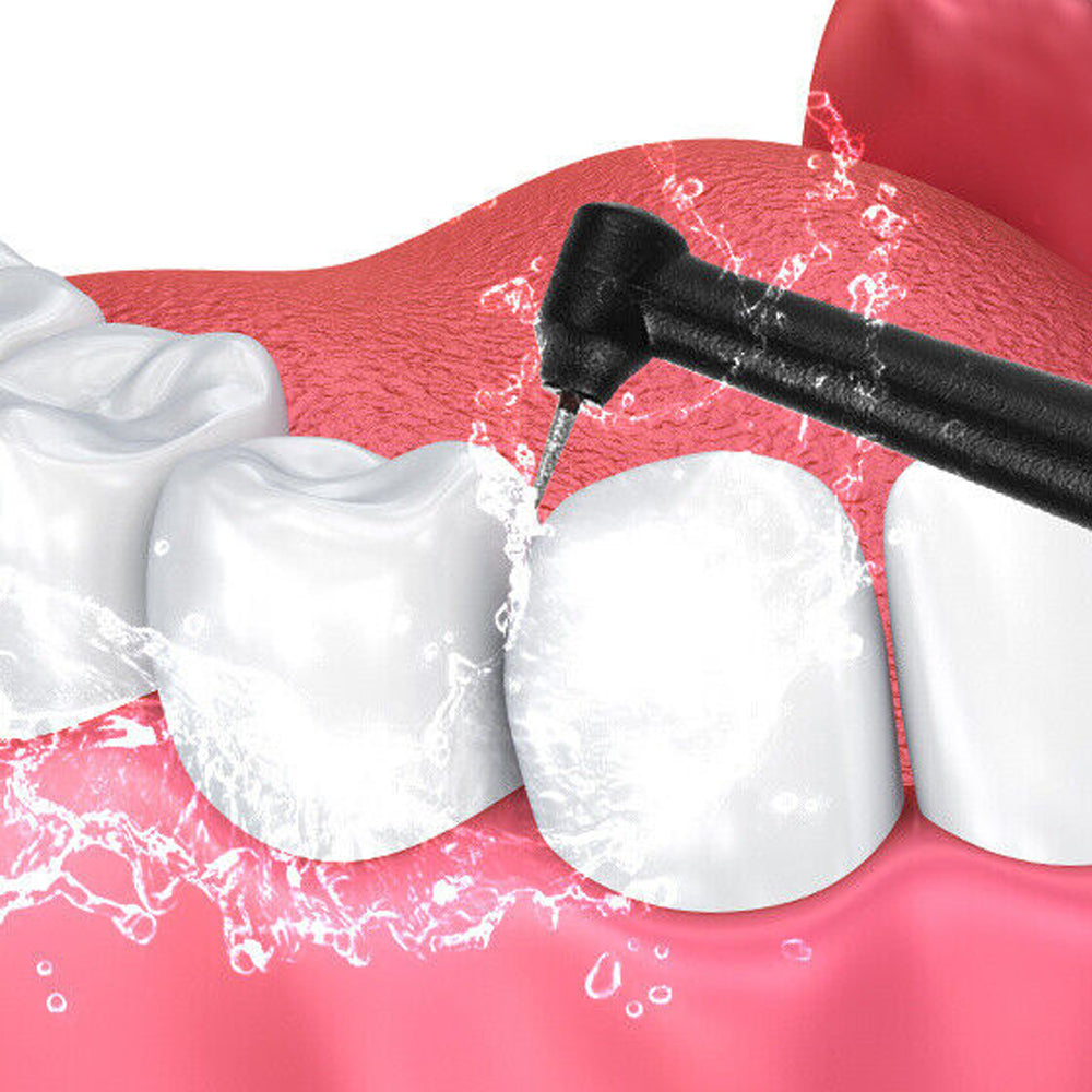 Electric Teeth Cleaning Kit