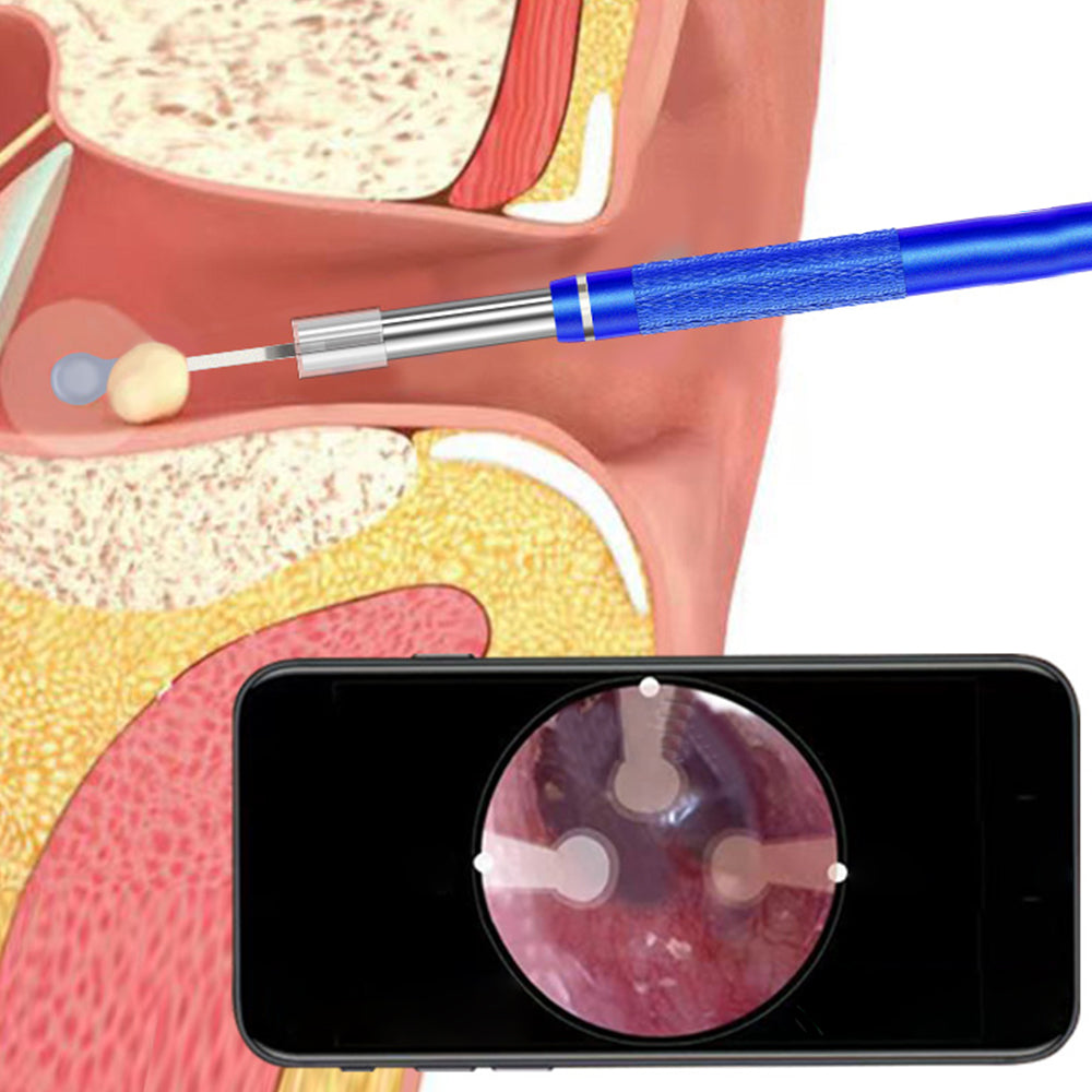 Ear Wax Removal Endoscope Earwax Remover Tool Ear Camera Ear Otoscope with 6 LED Lights