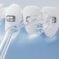 Portable Cordless Water Flosser for Teeth Deep Cleaning