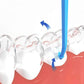 12Pcs Invisible Aligner Removal Tool with Wide Cap and Non-Slip Handle