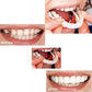 2Pcs Snap On Cosmetic Instant Smile Comfort Teeth Sockets