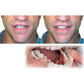 2Pcs Snap On Cosmetic Instant Smile Comfort Teeth Sockets