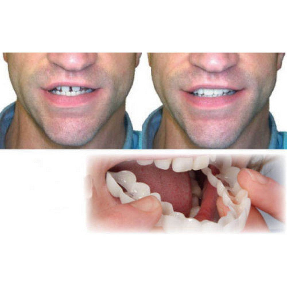 2Pcs Snap On Cosmetic Instant Smile Comfort Teeth Sockets