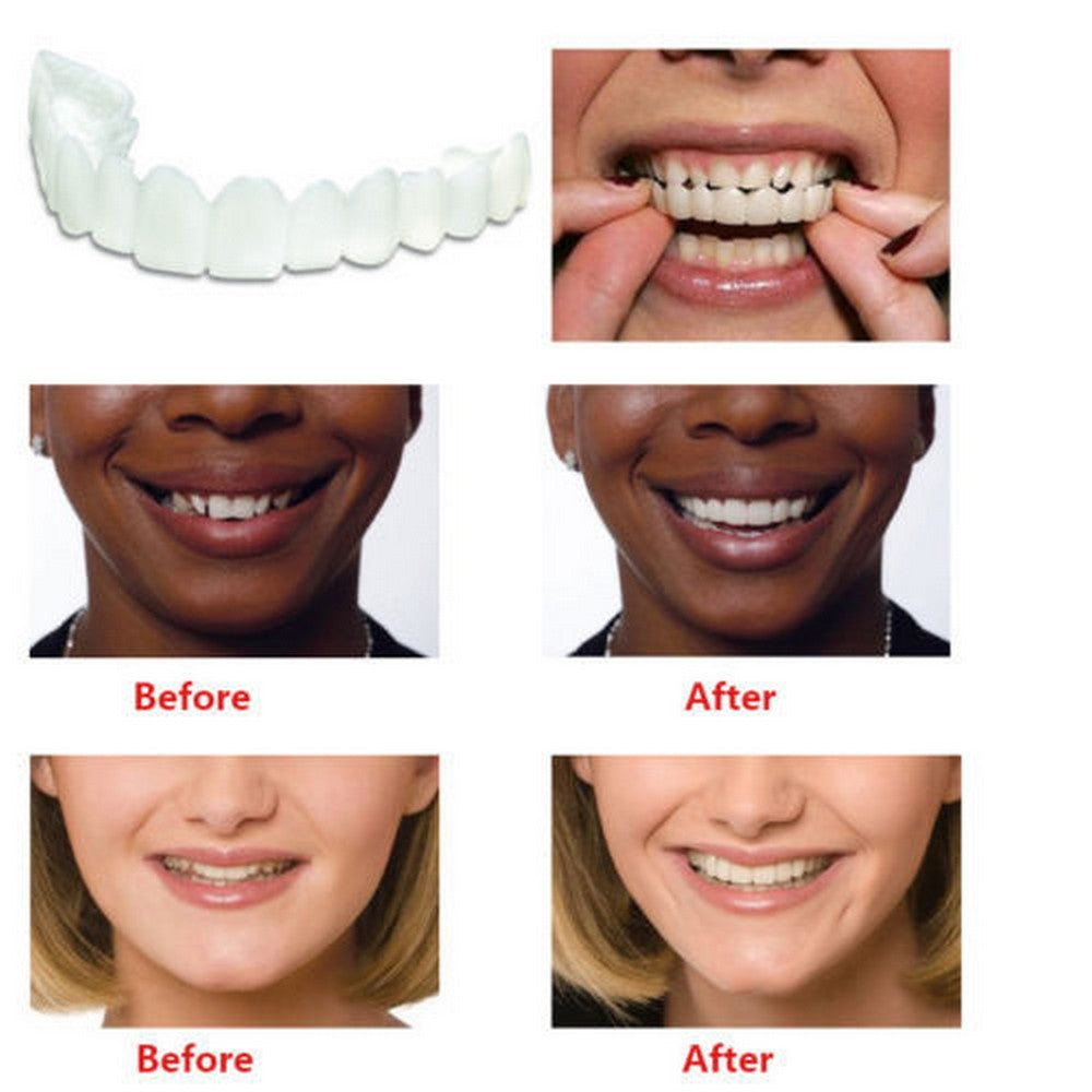 2Pcs Snap On Cosmetic Instant Smile Comfort Teeth Sockets