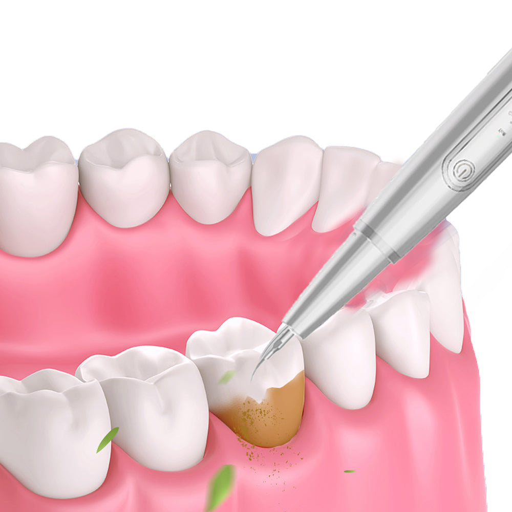 Electric Dental Calculus Removal Teeth Cleaning Kit With LED Light