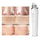 Blackhead Remover Pore Vacuum Suctioner 3 Suction Power and 6 Suction Heads WiFi Visible Facial Pore Cleanser with HD Camera