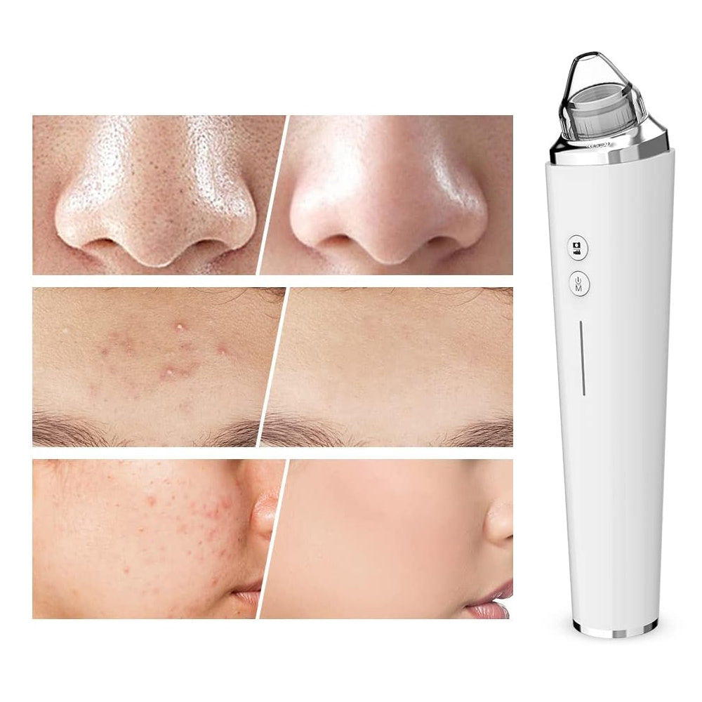 Blackhead Remover Pore Vacuum Suctioner 3 Suction Power and 6 Suction Heads WiFi Visible Facial Pore Cleanser with HD Camera