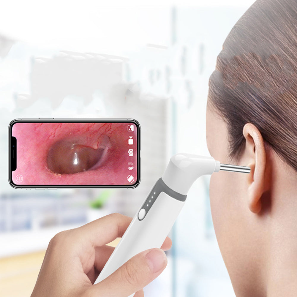 3.9mm WiFi Ear Scope Camera with Earwax Removal Tool 6 LED Lights Ear Endoscope Otoscope
