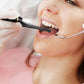 Electric Teeth Cleaning Kit